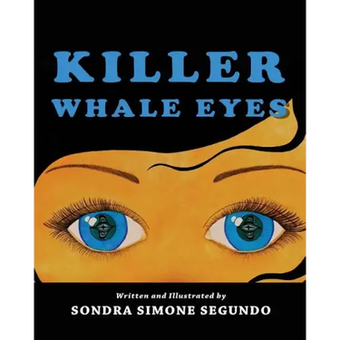 Killer Whale Eyes