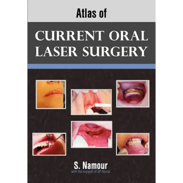 Atlas of Current Oral Laser Surgery