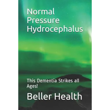2019 Normal Pressure Hydrocephalus: This Dementia Strikes all Ages!