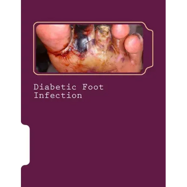 Diabetic Foot Infection