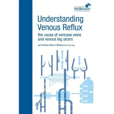 Understanding Venous Reflux the Cause of Varicose Veins and Venous Leg Ulcers: Varicose veins and venous leg ulcers
