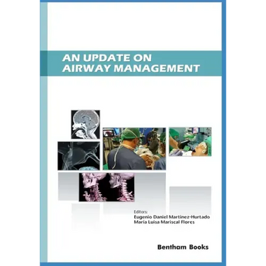 An Update on Airway Management
