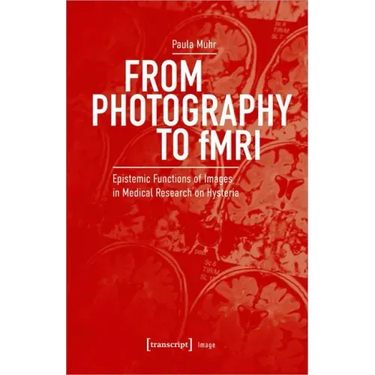 From Photography to Fmri: Epistemic Functions of Images in Medical Research on Hysteria