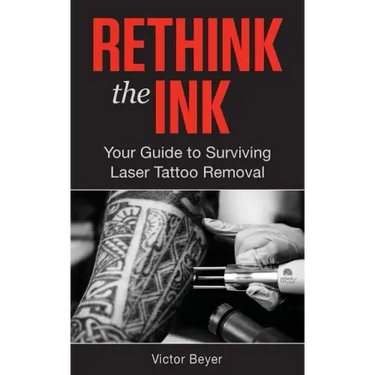Rethink the Ink: Your Guide to Surviving Laser Tattoo Removal
