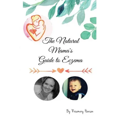 The Natural Mama's Guide To Eczema: Proven natural remedies for soft skin