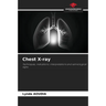 Chest X-ray