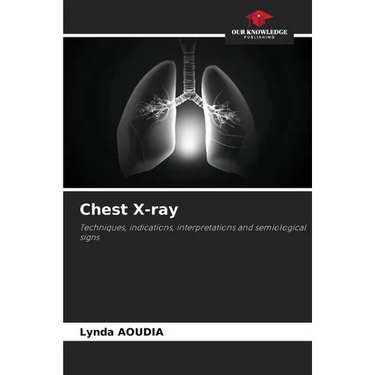 Chest X-ray