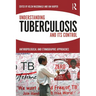 Understanding Tuberculosis and Its Control: Anthropological and Ethnographic Approaches