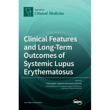 Clinical Features and Long-Term Outcomes of Systemic Lupus Erythematosus