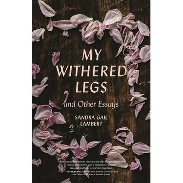 My Withered Legs and Other Essays