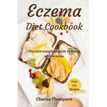 Eczema Diet Cookbook: The new complete guide to living with eczema. More than 100 recipes against the symptoms of dermatitis and psoriasis.