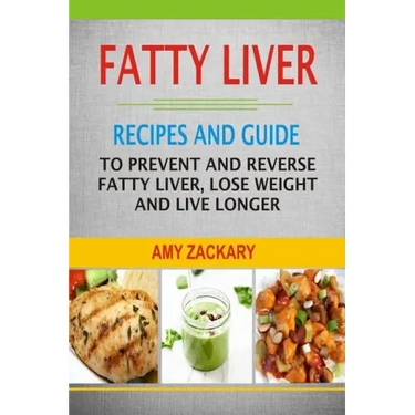 Fatty Liver: Recipes And Guide To Prevent And Reverse Fatty Liver, Lose Weight And Live Longer