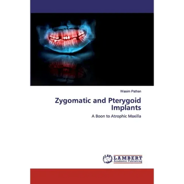 Zygomatic and Pterygoid Implants