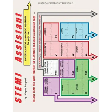 STEMI Assistant