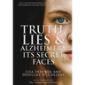 Truth, Lies & Alzheimer's: Its Secret Faces