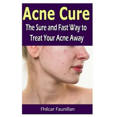 Acne Cure: The Sure and Fast Way to Treat Your Acne Away