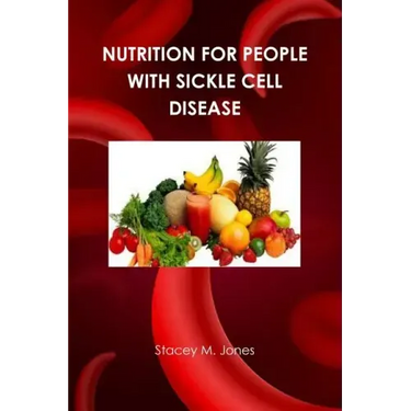 Nutrition for people with Sickle Cell Disease