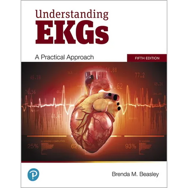 Understanding EKGs: A Practical Approach