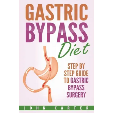 Gastric Bypass Diet: Step By Step Guide to Gastric Bypass Surgery