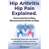 Hip Arthritis, Hip Pain Explained. Osteoarthritis in Hips, Rheumatoid Arthritis in Hips. Including Hip Arthritis Surgery, Hip Flexor Pain, Exercises,