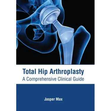 Total Hip Arthroplasty: A Comprehensive Clinical Guide