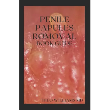 Penile Papules Romoval Book Guide: The Ultimate Guide On How To Remove Pearly Penile Papules Using Natural Remedies