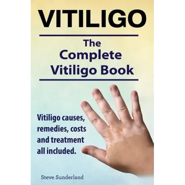 Vitiligo. Vitiligo causes, remedies, costs and treatment all included. The complete Vitiligo Book.