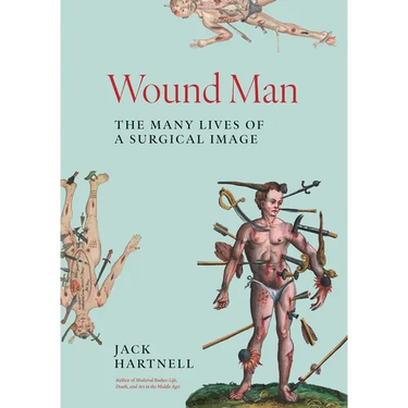 Wound Man: The Many Lives of a Surgical Image