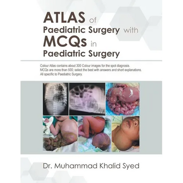 Atlas of Paediatric Surgery with Mcqs in Paediatric Surgery