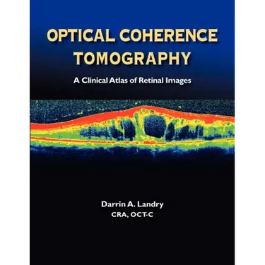 Optical Coherence Tomography a Clinical Atlas of Retinal Images