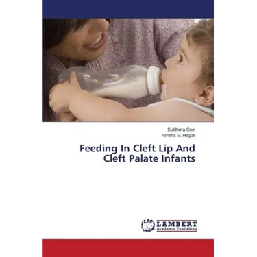 Feeding In Cleft Lip And Cleft Palate Infants