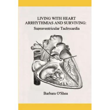 Living with Heart Arrhythmias and Surviving: Supraventricular Tachycardia