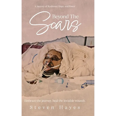 Beyond The Scars: A Journey of Resilience, Hope, and Power