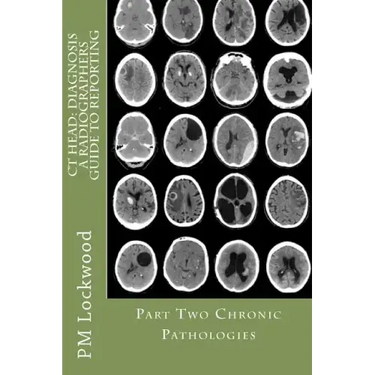 CT Head: DIAGNOSIS A Radiographers Guide To Reporting Part 2 Chronic Pathologies: Part 2 Chronic Pathologies
