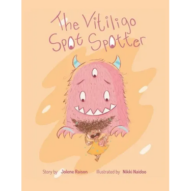 The Vitiligo Spot Spotter