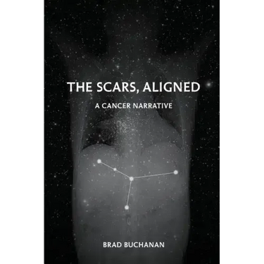 The Scars, Aligned