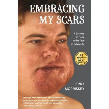 Embracing My Scars: A journey of hope in the face of adversity