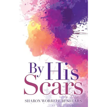 By His Scars