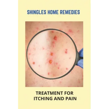 Shingles Home Remedies: Treatment For Itching And Pain: Shingles Recovery Stages