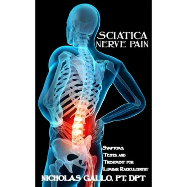 Sciatica Nerve Pain: Symptoms, Tests, and Treatments for Lumbar Radiculopathy