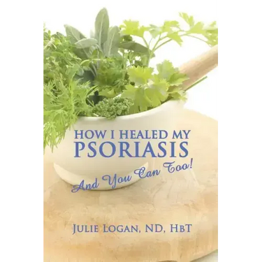How I Healed My Psoriasis: And You Can Too!