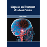 Diagnosis and Treatment of Ischemic Stroke