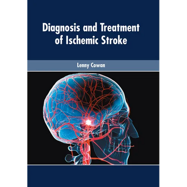 Diagnosis and Treatment of Ischemic Stroke