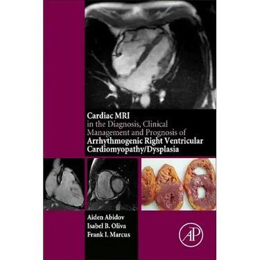 Cardiac MRI in Diagnosis, Clinical Management, and Prognosis of Arrhythmogenic Right Ventricular Cardiomyopathy/Dysplasia