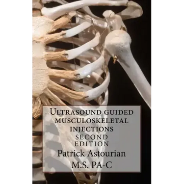 Ultrasound guided musculoskeletal injections