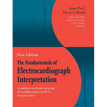 The Fundamentals of Electrocardiograph Interpretation: A medial textbook covering all considerations on ECG interpretation