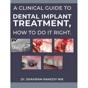 A clinical guide to dental implant treatment, how to do it right.