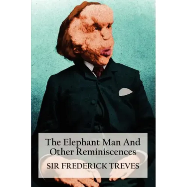 The Elephant Man and Other Reminiscences