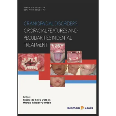 Craniofacial disorders - orofacial features and peculiarities in dental treatment