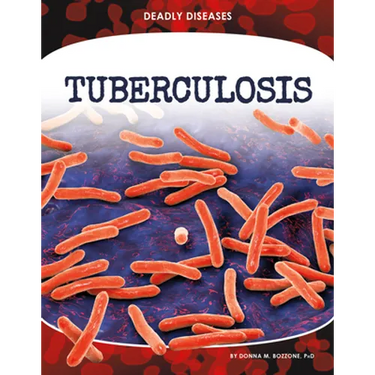 Tuberculosis